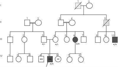 Optical genome mapping identifies a homozygous deletion in the non-coding region of the SCN9A gene in individuals from the same family with congenital insensitivity to pain